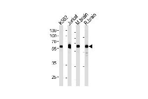 USP14 Antibody (N-term) (ABIN1882288 and ABIN2843485) western blot analysis in k562,Jurkat cell line ,mouse brain and rat brain tissue lysates (35 μg/lane).