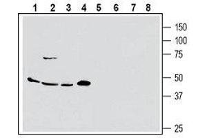 Western blot analysis of human MCF-7 breast adenocarcinoma (lanes 1 and 5), human Colo-205 colorectal adenocarcinoma (lanes 2 and 6), human PANC-1 pancreas ductal adenocarcinoma (lanes 3 and 7) and human Malme-3M melanoma cell line lysate (lanes 4 and 8): - 1-4. (SLC1A5 Antikörper  (2nd Extracellular Loop))