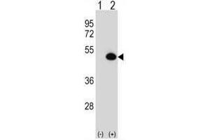 Western Blotting (WB) image for anti-Argininosuccinate Synthase 1 (ASS1) (AA 280-310), (C-Term) antibody (ABIN950542)