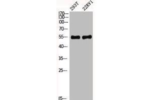 Western Blot analysis of 293T 22RV1 cells using Phospho-Akt1 (Y474) Polyclonal Antibody (AKT1 Antikörper  (pTyr474))