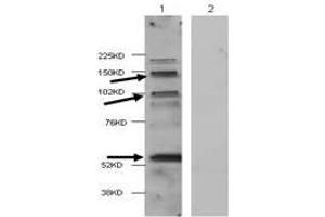 Western Blot of Rabbit anti-HDAC4 antibody. (HDAC4 Antikörper  (Internal Region))