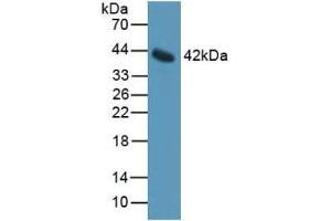 Detection of IL11Ra in Mouse Serum using Polyclonal Antibody to Interleukin 11 Receptor Alpha (IL11Ra) (IL11RA Antikörper  (AA 194-329))