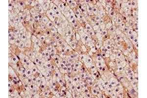 Immunohistochemistry (IHC) image for anti-Cadherin 18, Type 2 (CDH18) (AA 66-251) antibody (ABIN7146220)