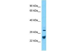 Host:  Rabbit  Target Name:  ATP1B1  Sample Type:  Thymus Tumor lysates  Antibody Dilution:  1. (ATP1B1 Antikörper  (C-Term))