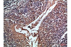 Immunohistochemical analysis of paraffin-embedded Human-tonsil, antibody was diluted at 1:100 (CD24 Antikörper  (AA 30-60))