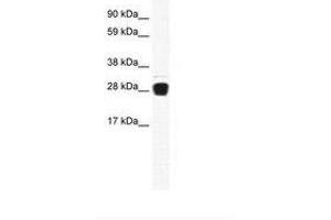 Image no. 1 for anti-Tumor Necrosis Factor (Ligand) Superfamily, Member 12 (TNFSF12) (AA 57-106) antibody (ABIN6736008)