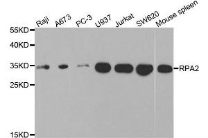 Western blot analysis of extracts of various cell lines, using RPA2 antibody. (RPA2 Antikörper)