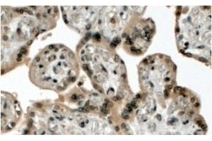 AP32078PU-N MLL2 Antibody staining of paraffin embedded Human Placenta at 4 µg/ml. (MLL2 Antikörper  (N-Term))