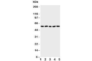 Western blot testing of Syndecan 3 antibody and Lane 1: human U87;  2: (h) 293T;  3: rat PC12;  4: (r) NRK;  5: (h) HT1080 cell lysate (SDC3 Antikörper  (N-Term))