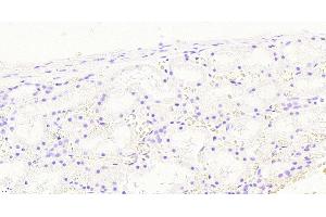 (ABIN768583) Negative Control showing staining of paraffin embedded Human Kidney, with no primary antibody. (NOX1 Antikörper  (Internal Region))