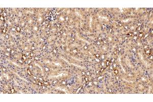 Immunohistochemistry (IHC) image for anti-Gelsolin (GSN) (AA 674-782) antibody (ABIN7442174)