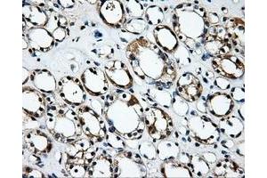 Immunohistochemical staining of paraffin-embedded Kidney tissue using anti-RALBP1mouse monoclonal antibody. (RALBP1 Antikörper)