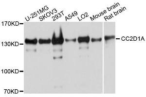 CC2D1A Antikörper  (AA 1-150)