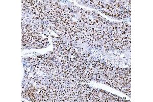 IHC analysis of FEN1 using anti-FEN1 antibody (ABIN7601617). (FEN1 Antikörper  (AA 4-300))