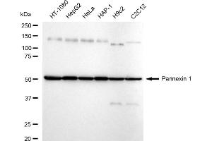 Western blotting analysis using Pannexin 1 antibody (ABIN7799733).
