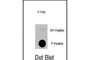 Dot blot analysis of anti-PDPK1-p Phospho-specific Pab (R) on nitrocellulose membrane. (PDPK1 Antikörper  (pSer396))