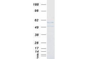 FIZ1 Protein (Myc-DYKDDDDK Tag)