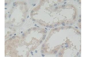 Immunohistochemistry (IHC) image for anti-Receptor Tyrosine Kinase-Like Orphan Receptor 2 (ROR2) (AA 683-934) antibody (ABIN7443737)