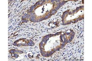 IHC analysis of RRS1 using anti-RRS1 antibody (ABIN7602918). (RRS1 Antikörper  (C-Term))