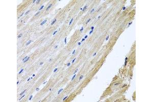 Immunohistochemistry of paraffin-embedded Rat heart using PRPH Polyclonal Antibody at dilution of 1:100 (40x lens). (Peripherin Antikörper)