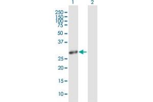 Western Blotting (WB) image for anti-Heme Oxygenase (Decycling) 1 (HMOX1) (AA 1-288) antibody (ABIN516552)