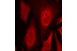 Immunofluorescence staining of methanol-fixed Hela cells using phospho-EIF2S1-S49 antibody. (EIF2S1 Antikörper  (pSer49))