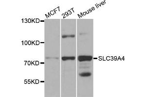 Western blot analysis of extracts of various cell lines, using SLC39A4 antibody (ABIN5971796) at 1/1000 dilution. (SLC39A4 Antikörper)