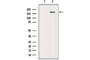 Western blot analysis of extracts from B16F10, using Ret Antibody.