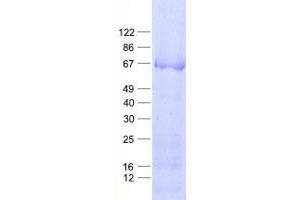 Validation with Western Blot (Keratin 84 Protein (KRT84) (His tag))