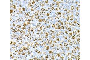 Immunohistochemistry of paraffin-embedded Mouse stomach using DLK1 Polyclonal Antibody at dilution of 1:100 (40x lens). (DLK1 Antikörper)