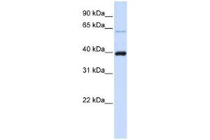 PHF6 antibody used at 0. (PHF6 Antikörper  (C-Term))