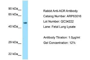 Western Blotting (WB) image for anti-Acrosin (ACR) (C-Term) antibody (ABIN2789340) (Acrosin Antikörper  (C-Term))