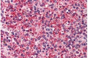 Human Spleen (formalin-fixed, paraffin-embedded) stained with KIAA1303 antibody ABIN214505 at 2. (Raptor Antikörper)