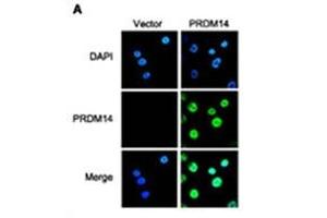 IFanalysis of PRDM14 in breast cancer cells. (PRDM14 Antikörper  (N-Term))
