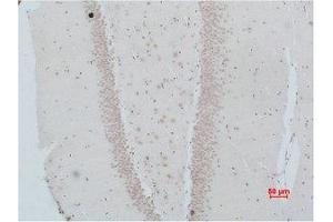 Immunohistochemistry (IHC) analysis of paraffin-embedded Rat Brain Tissue using NMBR Polyclonal Antibody. (NMBR Antikörper)