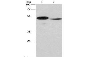 Western Blot analysis of Mouse panceas tissue and NIH/3T3 cell using IRF9 Polyclonal Antibody at dilution of 1:380 (IRF9 Antikörper)