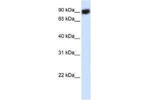 WB Suggested Anti-HSP90B1 Antibody Titration:  0. (GRP94 Antikörper  (C-Term))