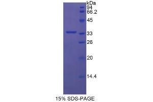 SDS-PAGE analysis of Human Semaphorin 7A Protein. (SEMA7A Protein)