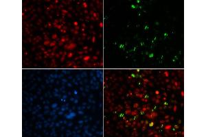 Immunofluorescence (IF) image for anti-Centrin, EF-Hand Protein, 2 (CETN2) antibody (ABIN1876585) (CETN2 Antikörper)