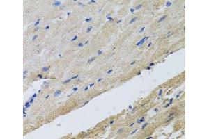 Immunohistochemistry of paraffin-embedded Rat heart using FECH Polyclonal Antibody at dilution of 1:100 (40x lens). (FECH Antikörper)
