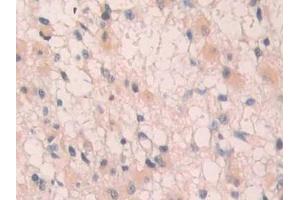 Immunohistochemistry (IHC) image for anti-Interleukin 1 Receptor, Type I (IL1R1) (AA 226-318) antibody (ABIN7437953)