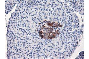 Immunohistochemical staining of paraffin-embedded Human pancreas tissue using anti-ACSS2 mouse monoclonal antibody. (ACSS2 Antikörper)