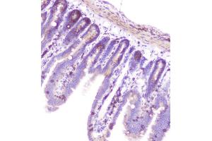 IHC analysis of RASAL1 using anti-RASAL1 antibody (ABIN6719367). (RASAL1 Antikörper  (AA 721-798))