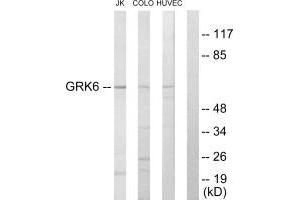 Western blot analysis of extracts from Jurkat cells, COLO205 cells and HUVEC cells, using GRK6 antibody. (GRK6 Antikörper  (N-Term))