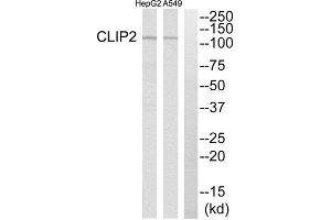 Western Blotting (WB) image for anti-CAP-GLY Domain Containing Linker Protein 2 (CLIP2) (C-Term) antibody (ABIN1850986) (CLIP2 Antikörper  (C-Term))
