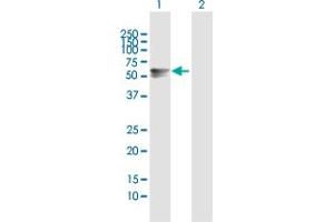 Western Blot analysis of ARSA expression in transfected 293T cell line by ARSA MaxPab polyclonal antibody. (Arylsulfatase A Antikörper  (AA 1-507))