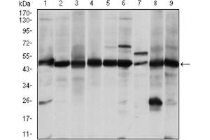 Western Blotting (WB) image for anti-Argininosuccinate Synthase 1 (ASS1) antibody (ABIN1845465)