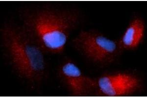 Immunofluorescence (IF) image for anti-Complexin 1 (CPLX1) (AA 1-134) antibody (PE) (ABIN5565320) (Complexin 1 Antikörper  (AA 1-134) (PE))