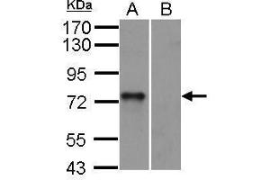 Western Blotting (WB) image for anti-Spleen tyrosine Kinase (SYK) (Internal Region) antibody (ABIN2854855)