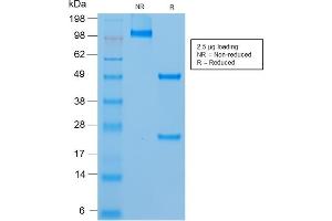 SDS-PAGE Analysis of Purified MUC18 Mouse Recombinant Monoclonal Antibody (rMUC18/1130). (Rekombinanter MCAM Antikörper)